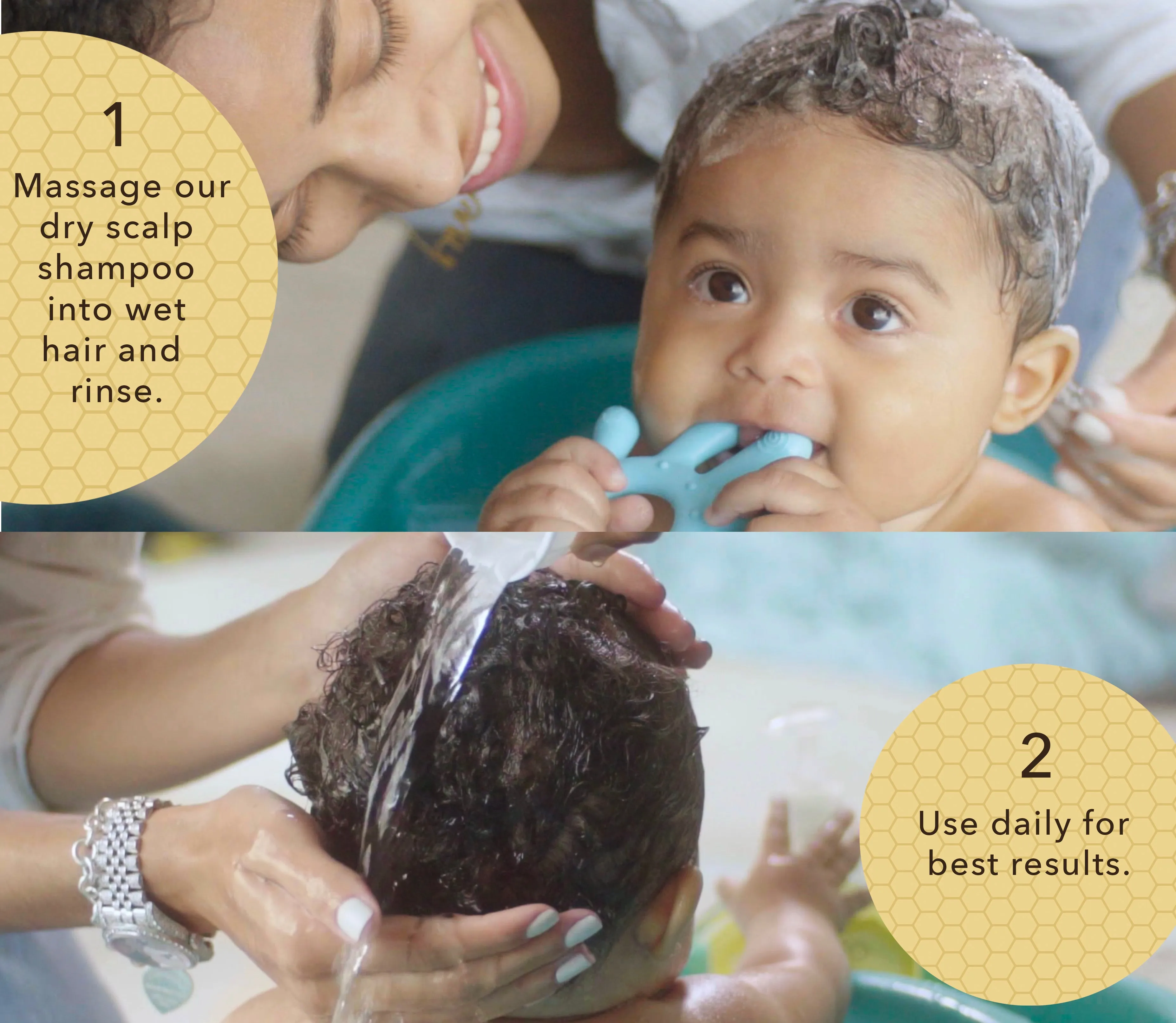 Bee Gone Cradle Cap Baby Shampoo 8oz